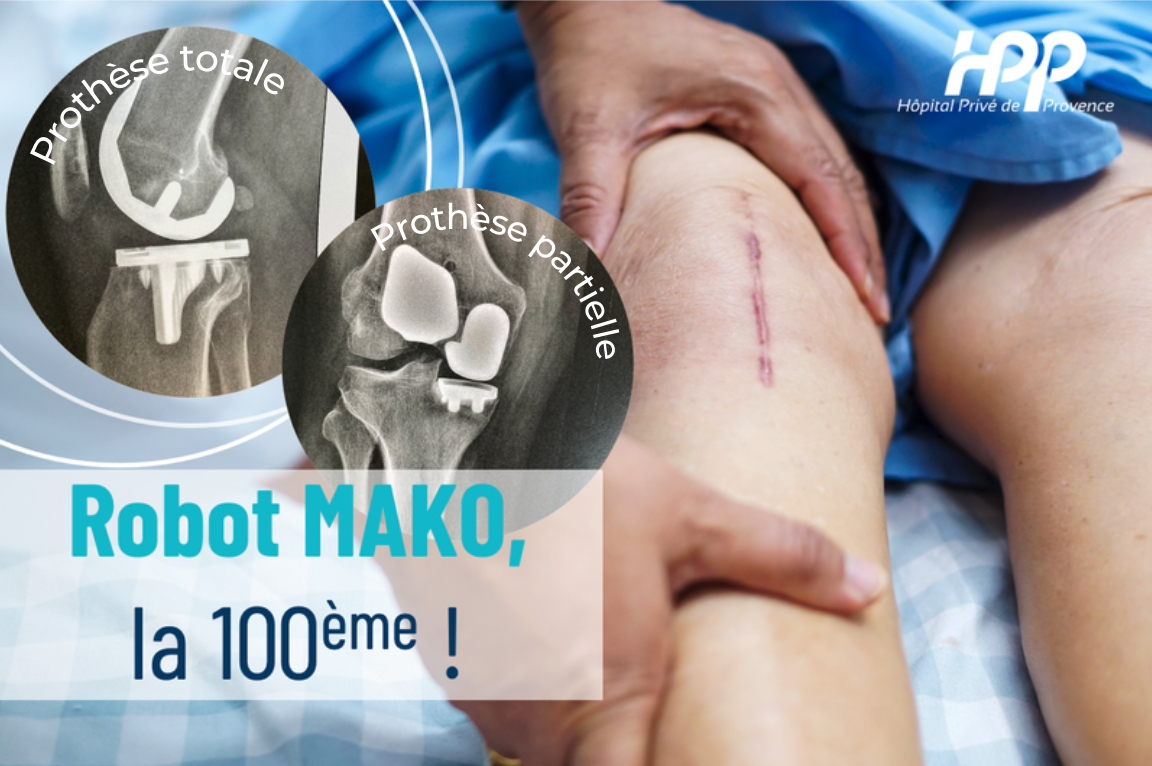 Robot Mako®, la 100ème !